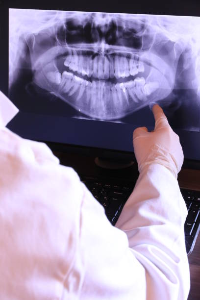 Best Emergency Denture Repair in New Hackensack, NY